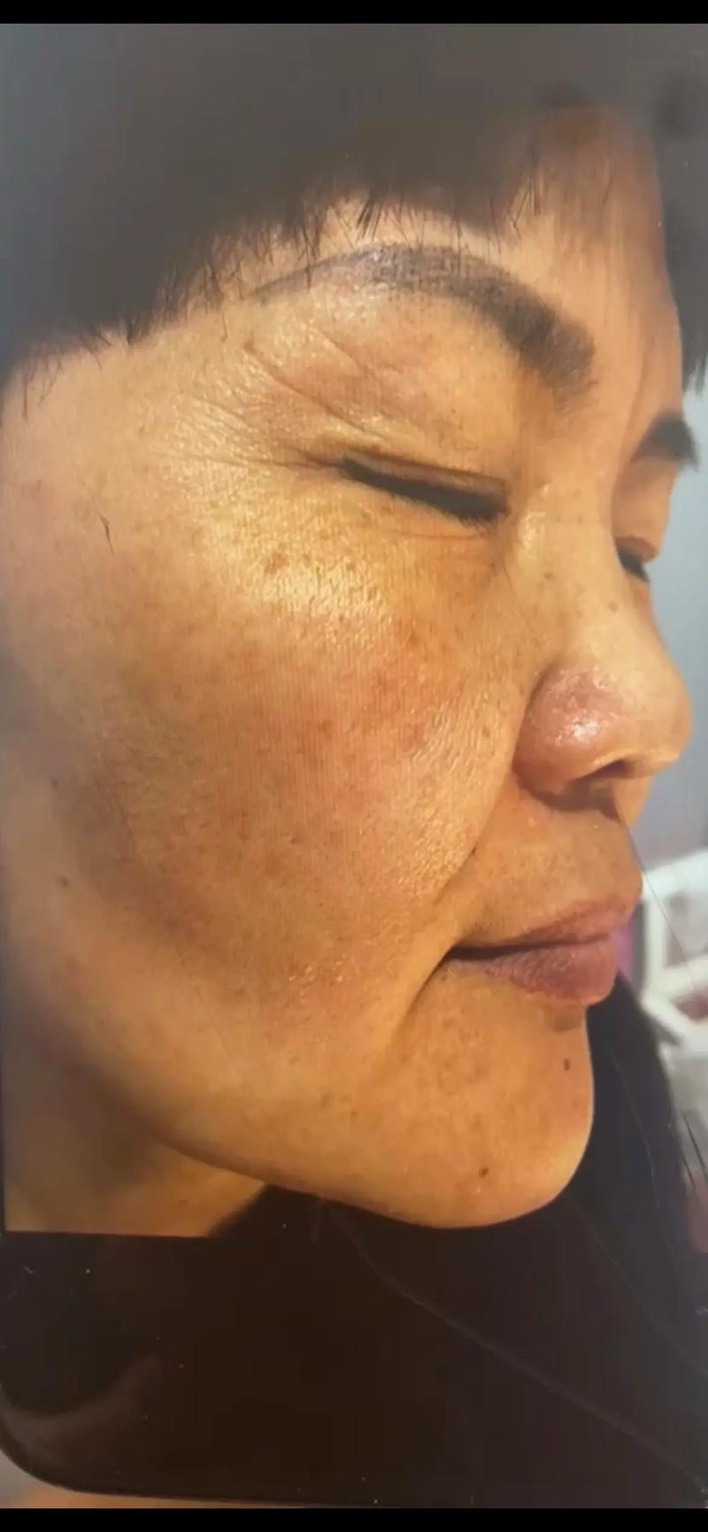 皮肤暗黄怎么调理